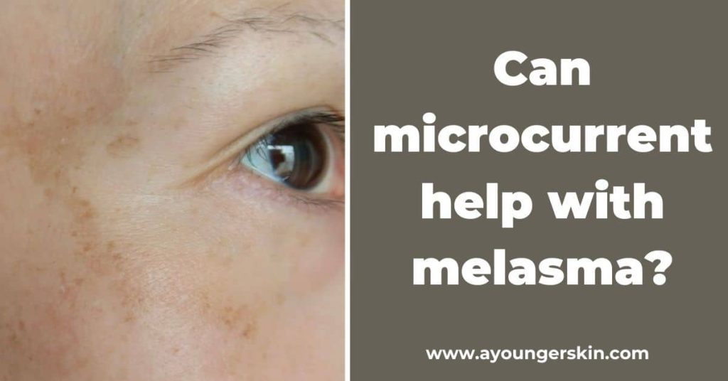 Can Microcurrent help with Melasma? (Before & After using ZIIP Halo) – A younger skin Can Microcurrent help with Melasma? (Before & After using ZIIP Halo) - A younger skin