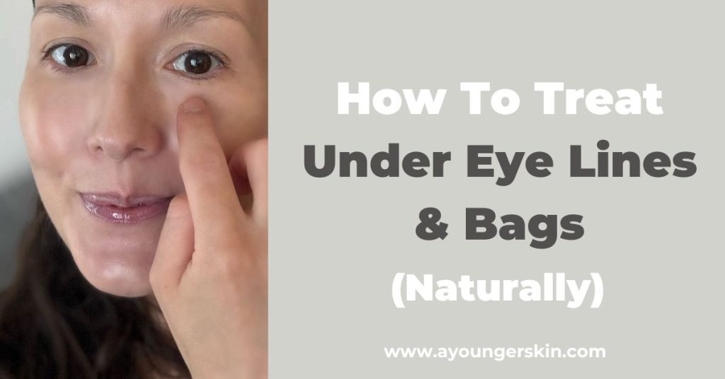 How to treat under eye lines and eye bags [naturally] - A younger skin
