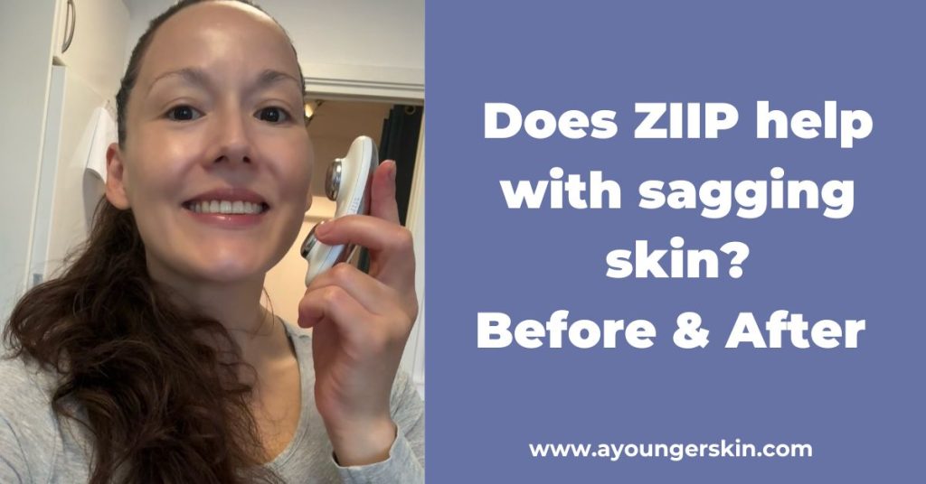 Does ZIIP help with sagging skin? - Before & After - A younger skin